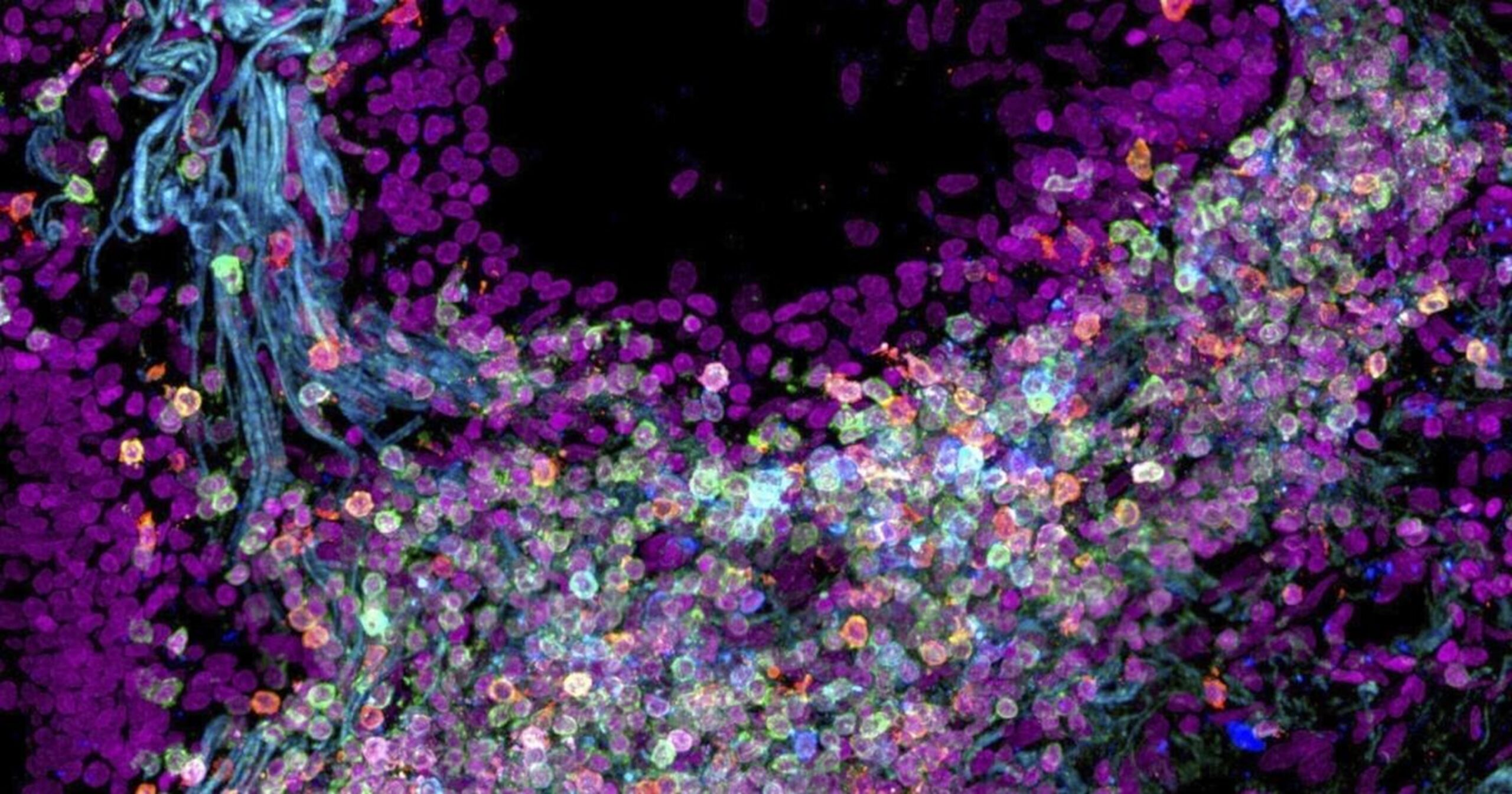 Investigadores han creado un mapa preliminar de algunas de las cerca de 37.2 billones de células en el cuerpo humano. 