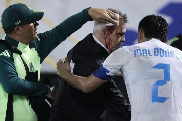 Tras el silbatazo final, 'El Vasco' se acercó a despedirse del colombiano Reinaldo Rueda, timonel del conjunto catracho, pero el impacto de una lata de cerveza en su frente provocó que corrieran varios ríos de sangre sobre su rostro. 