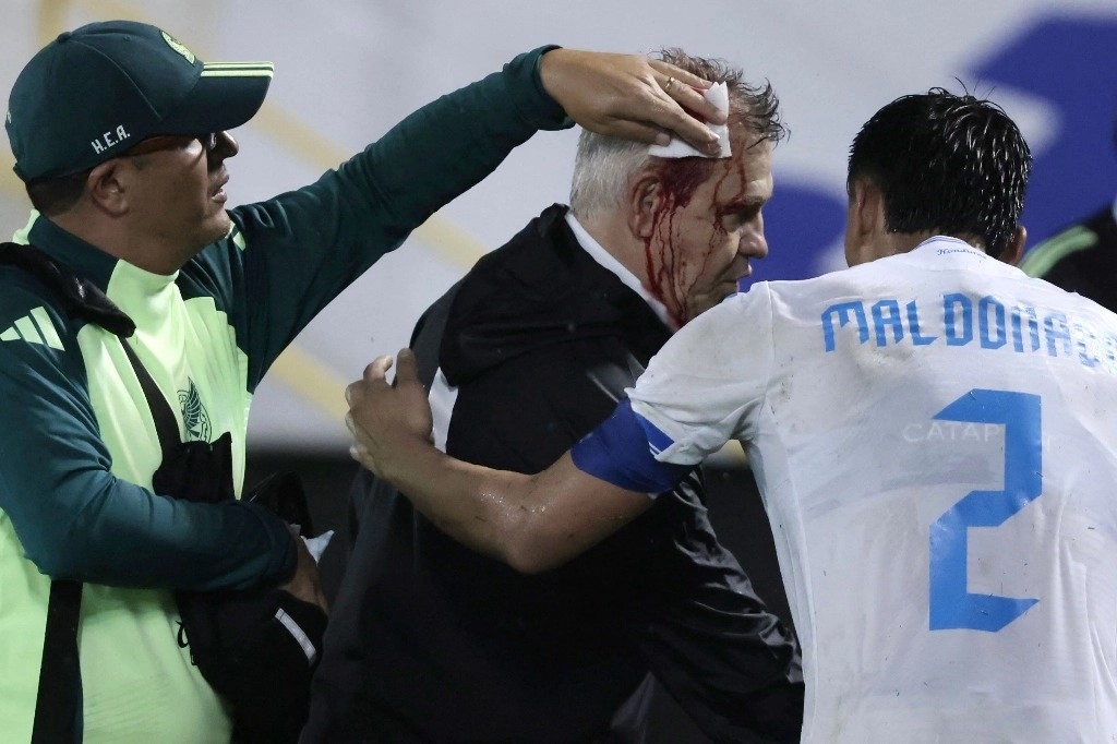 Tras el silbatazo final, 'El Vasco' se acercó a despedirse del colombiano Reinaldo Rueda, timonel del conjunto catracho, pero el impacto de una lata de cerveza en su frente provocó que corrieran varios ríos de sangre sobre su rostro. 