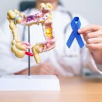 El Grupo de Tratamiento de Tumores Digestivos (TTD) destacó la importancia de conocer los factores de riesgo que pueden aumentar la probabilidad de aparición de tumores colorrectales