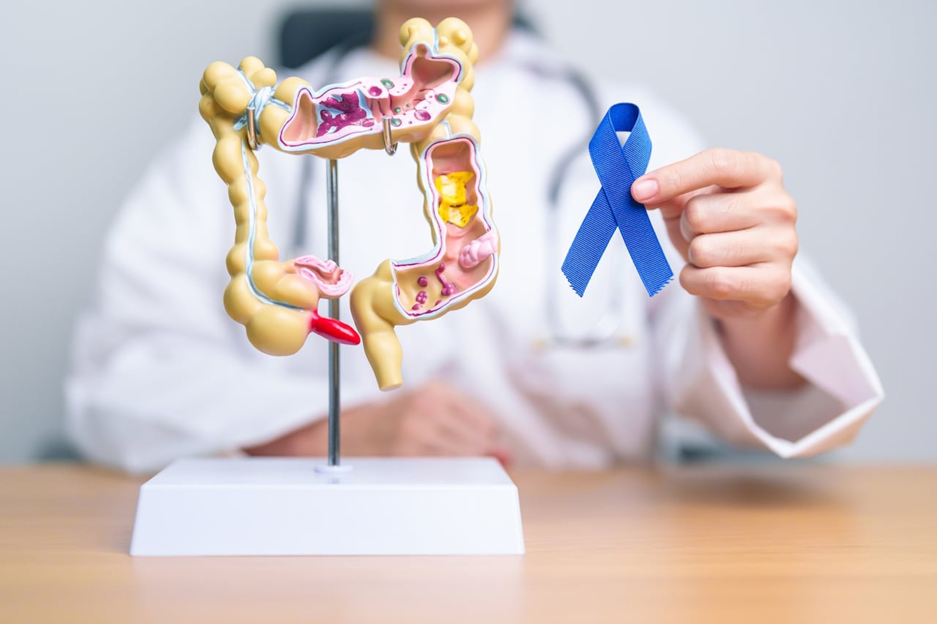 El Grupo de Tratamiento de Tumores Digestivos (TTD) destacó la importancia de conocer los factores de riesgo que pueden aumentar la probabilidad de aparición de tumores colorrectales