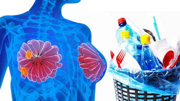 Investigadores de la Universidad Nacional Autónoma de México (UNAM) identificaron que ciertos componentes de plástico son un factor de riesgo que podrían influir en la aparición y progresión del cáncer de mama. 