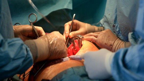 Un equipo de investigadores de la Universidad de Guangzhou (China) llevó a cabo el primer trasplante de un pulmón de cerdo modificado genéticamente a un humano de 39 años con muerte cerebral tras una hemorragia cerebral. El xenoinjerto pulmonar mantuvo su viabilidad y funcionalidad durante las 216 horas (9 días) del periodo de seguimiento, sin signos de rechazo hiperagudo ni infección.